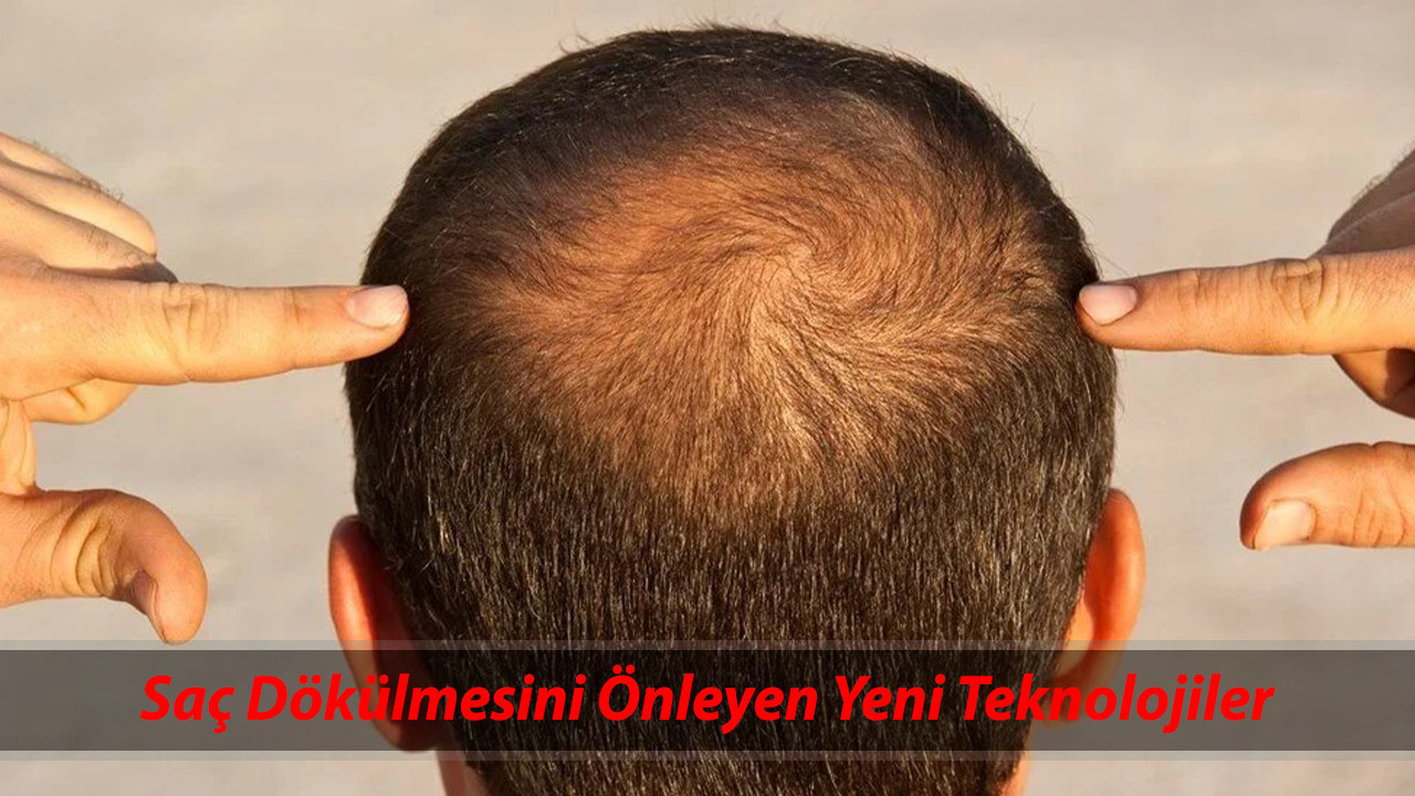 Saç Dökülmesini Önleyen Yeni Teknolojiler