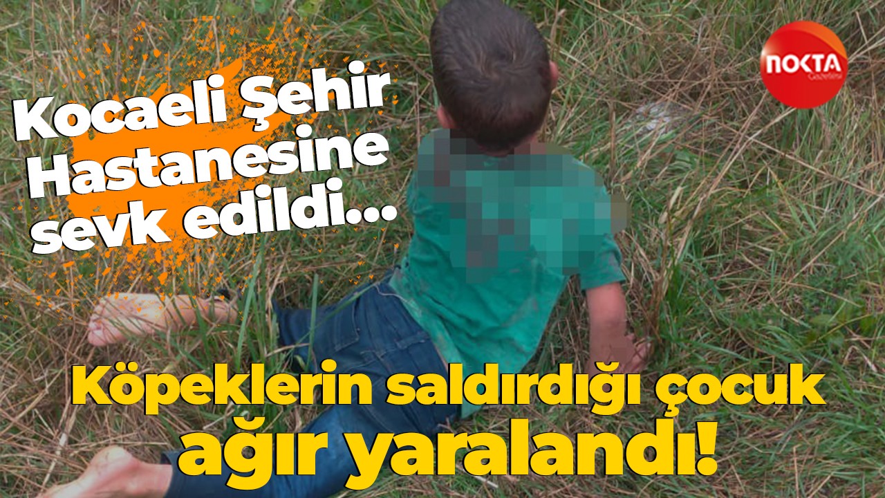 Kocaeli Şehir Hastanesine sevk edildi… Köpeklerin saldırdığı çocuk ağır yaralandı!