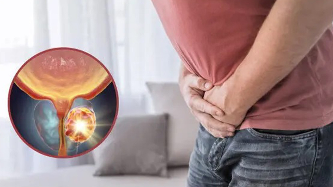 Prostat Nedir? Belirtileri Neler, Nasıl Geçer?