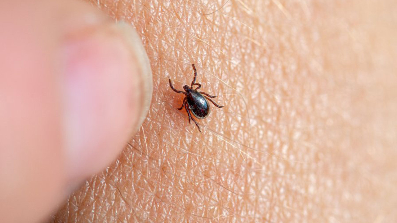 Kene Isırması Nedir? Belirtileri, Tedavisi
