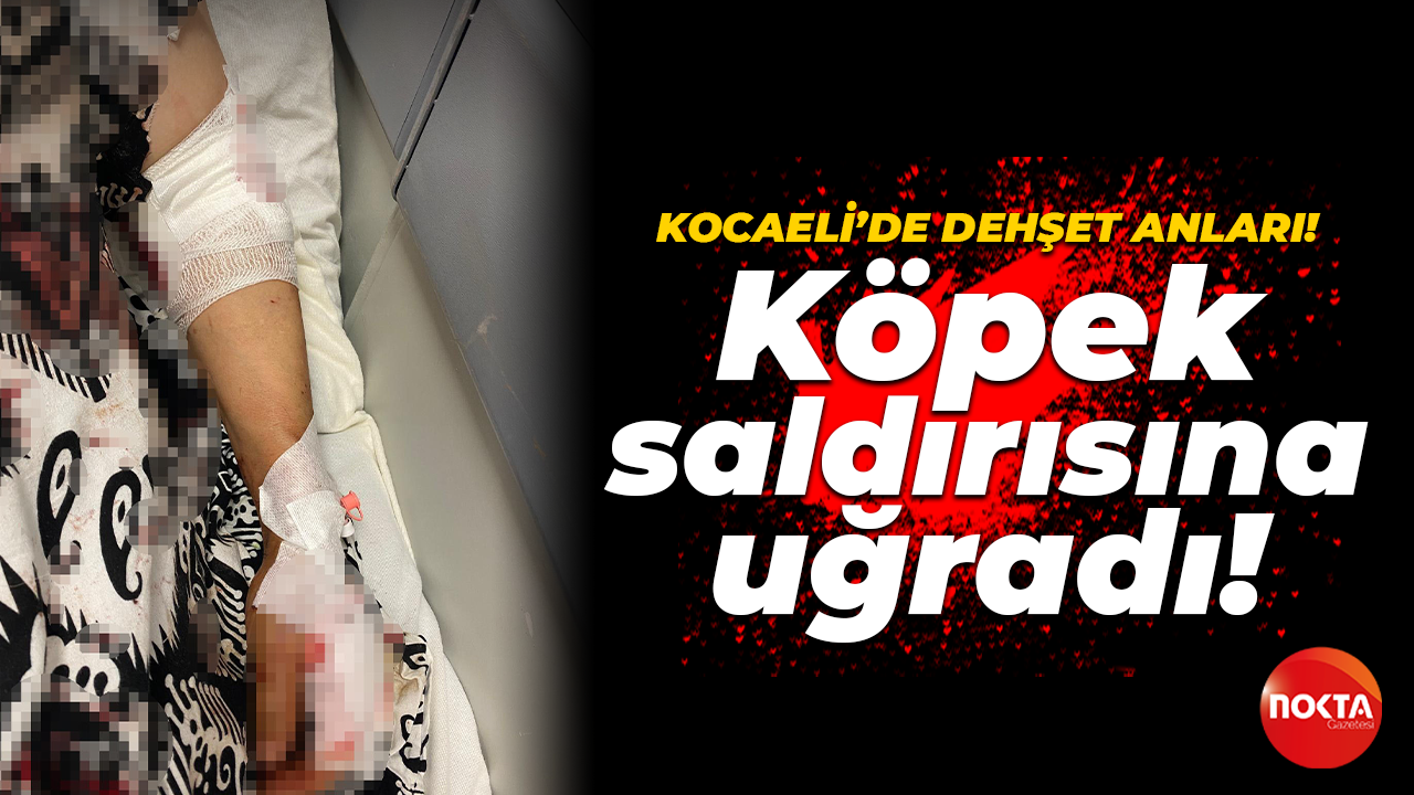 Kocaeli'de dehşet dolu olay: Sokak köpeklerinin saldırısına uğradı!