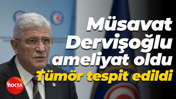 Müsavat Dervişoğlu ameliyat oldu... Tümör tespit edildi