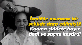 İzmit’te acımasız bir şekilde darp edilmişti! Kadına şiddete hayır dedi ve saçını kestirdi