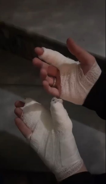 Kutlamalar meşale yanığıyla bitti - Resim : 2
