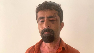 Antalya'da öfkeli damat kayınpederini hastanelik etti