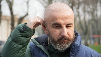 Bursa'da yaşayan vatandaş saç ektirmek isterken kulaklarından oldu