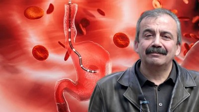 Sırrı Süreyya Önder Aort Damarı Nasıl Yırtılır? Aort Damarı Nerede? Aort Damarı Yırtılırsa Ne Olur?