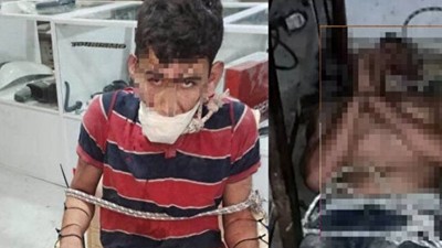 Dişlerini söktüler, hamam böceği yedirdiler! Rapor ortaya çıktı