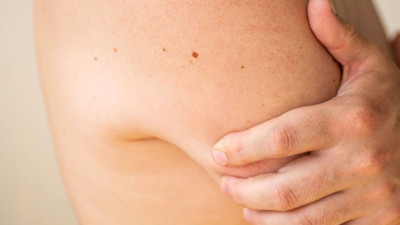 YUMUŞAK DOKU SARKOMU BELİRTİLERİ: Yumuşak Doku Kanseri Nedir? Yumuşak Doku Kanseri Ölüm Oranı