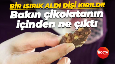Bir ısırık aldı dişi kırıldı! Bakın çikolatanın içinden ne çıktı