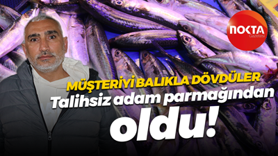 Müşteriyi balıkla dövdüler! Talihsiz adam parmağından oldu