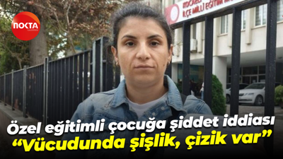 Özel eğitimli çocuğa şiddet iddiası; “Vücudunda şişlik, çizik var”