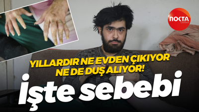 Yıllardır ne evden çıkıyor ne de duş alıyor! İşte sebebi...