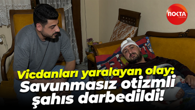 Vicdanları yaralayan olay: Savunmasız otizmli şahıs darbedildi!