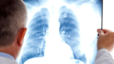 Uzman isim uyardI: Kış aylarında KOAH'a dikkat!