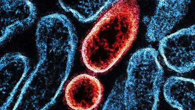 Sessiz yayılan hastalık neden yeniden ortaya çıktı!