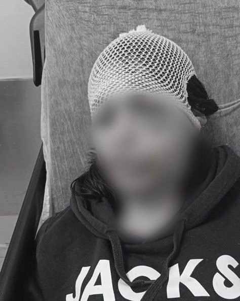 Kafasında şişe kırdı, bıçakla yüzünü kesti… İşkenceci sevgili ilk duruşmada serbest kaldı! - Resim : 2