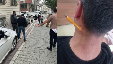 Esenyurt'ta taksiciye saldırı! Müşteri gibi bindi, tornavida sapladı