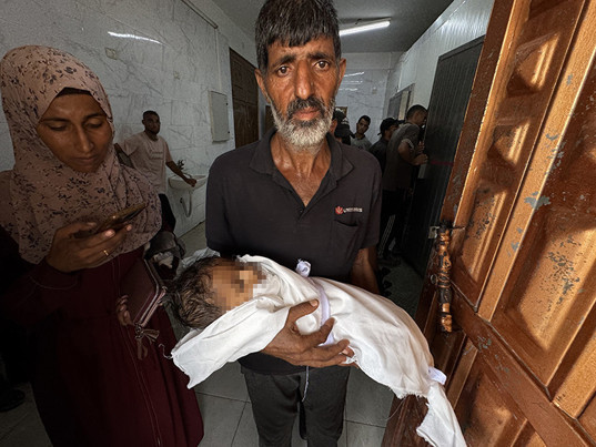 İsrail'in işgali altında ki Gazze'de son 24 saatte 5 kişi daha açlıktan hayatını kaybetti - Resim : 4