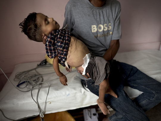 İsrail'in işgali altında ki Gazze'de son 24 saatte 5 kişi daha açlıktan hayatını kaybetti - Resim : 2