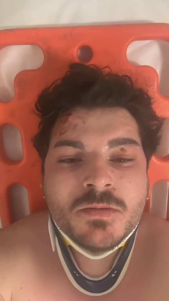 Trafikte yaşanan tartışmada darp edilen oyuncu dehşet anlarını anlattı! - Resim : 4