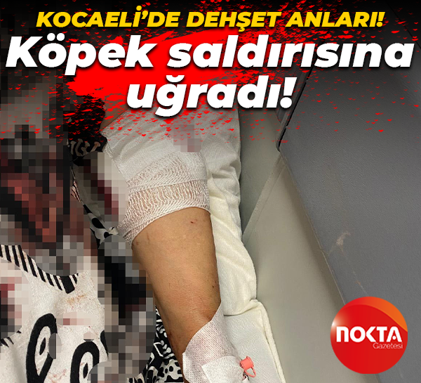 Kocaeli'de dehşet dolu olay: Sokak köpeklerinin saldırısına uğradı!