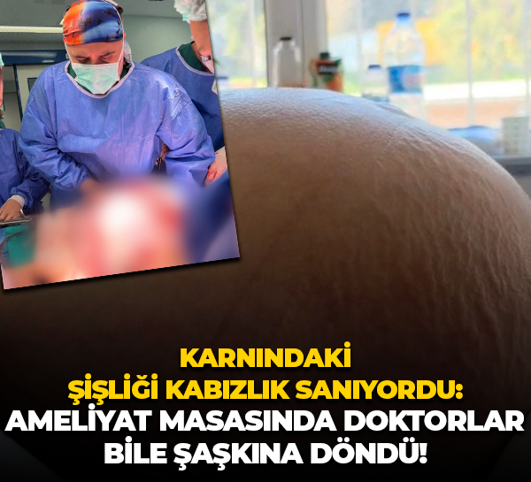 Karnındaki şişliği kabızlık sanıyordu: Ameliyat masasında doktorlar bile şaşkına döndü!