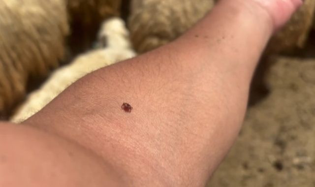 Vakalar fırladı... Binlerce kişi etkilendi! - Resim: 7