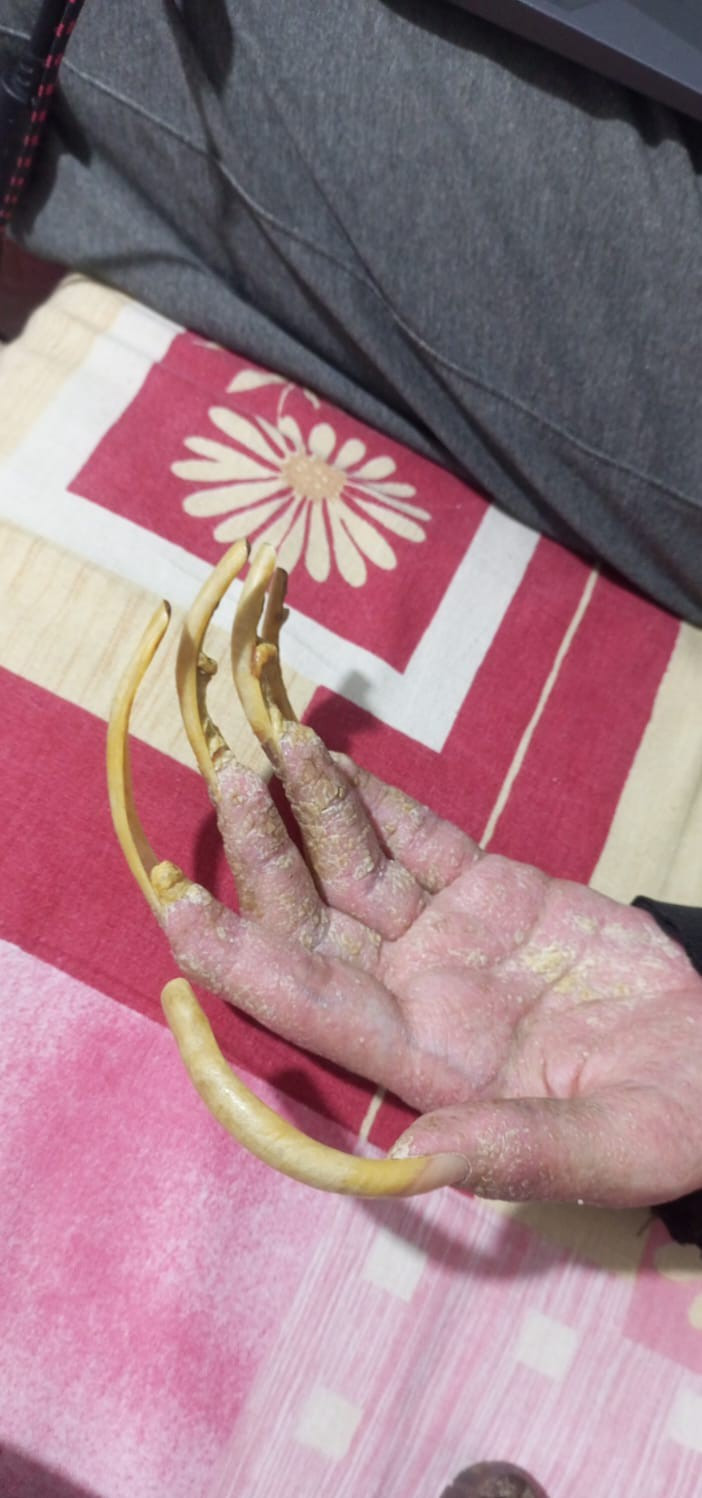 Yıllardır ne evden çıkıyor ne de duş alıyor! İşte sebebi... - Resim : 1