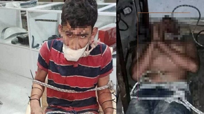 Dişlerini söktüler, hamam böceği yedirdiler! Rapor ortaya çıktı - Resim: 1