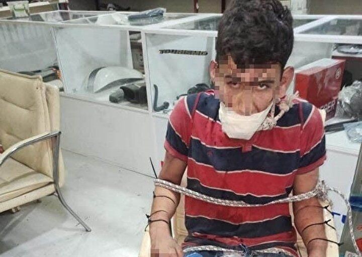 Dişlerini söktüler, hamam böceği yedirdiler! Rapor ortaya çıktı - Resim: 2