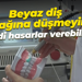 Beyaz diş tuzağına düşmeyin: Ciddi hasarlar verebilir!