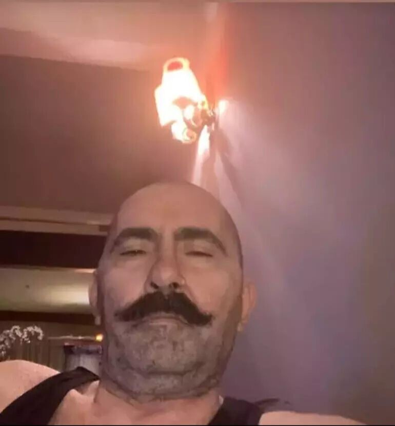 Peker Açıkalın hastanelik oldu! O görüntü sevenlerini korkuttu - Resim: 4