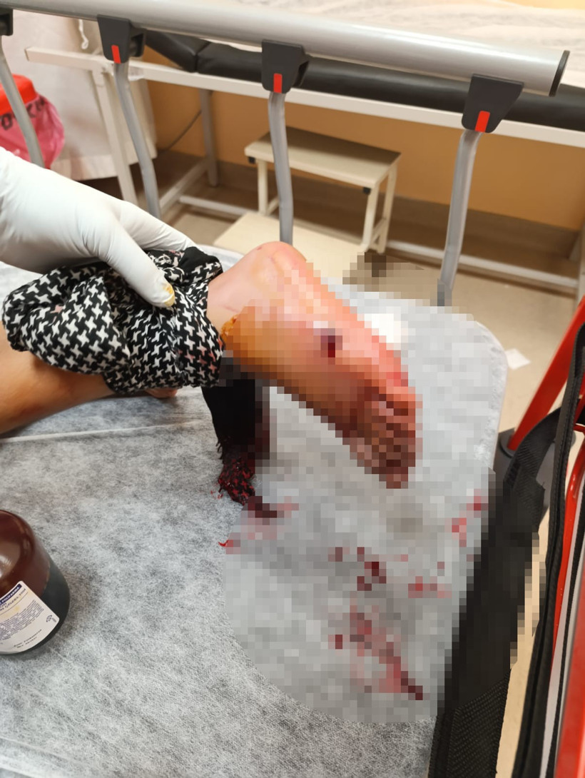 Balkonda oturan çocuğa kurşun isabet etti! - Resim : 2