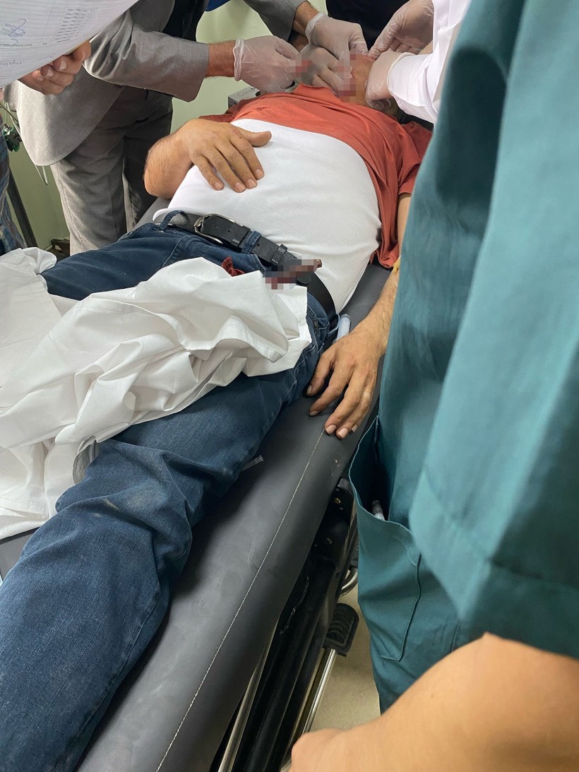 Feci kaza! İnşaat işçisinin yüzüne demir saplandı - Resim : 2