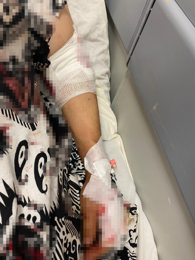 Kocaeli'de dehşet dolu olay: Sokak köpeklerinin saldırısına uğradı! - Resim : 1