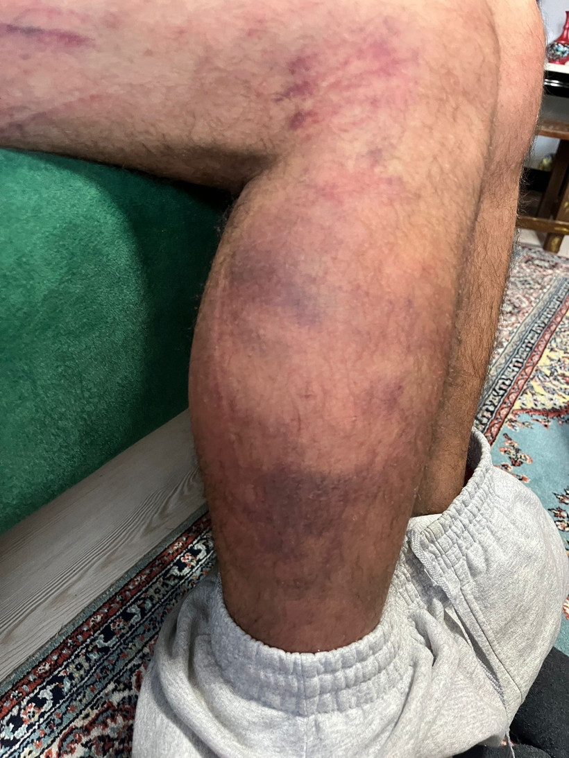 Engelli bireyi odunla darp etti, 3 yıl hapis cezası aldı! - Resim : 4