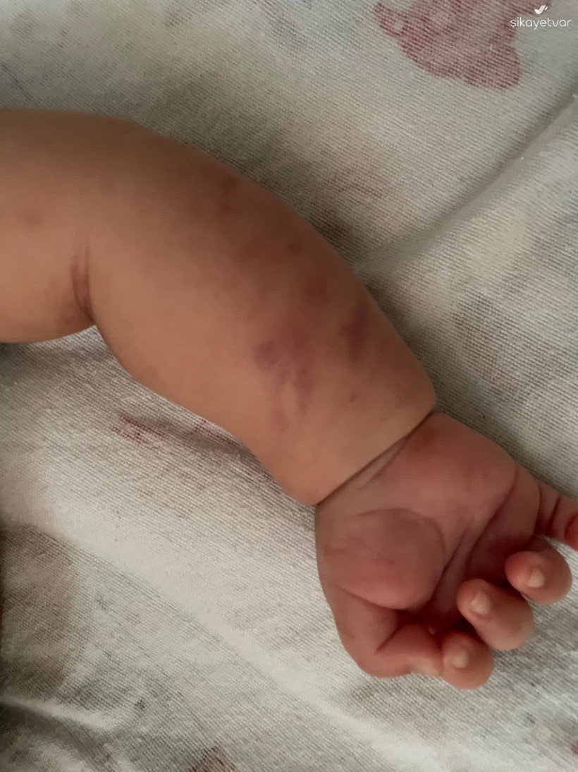 4 hemşire 2 aylık bebekten kan alamadı: Bebeğime adeta işkence çektirdiler - Resim : 2