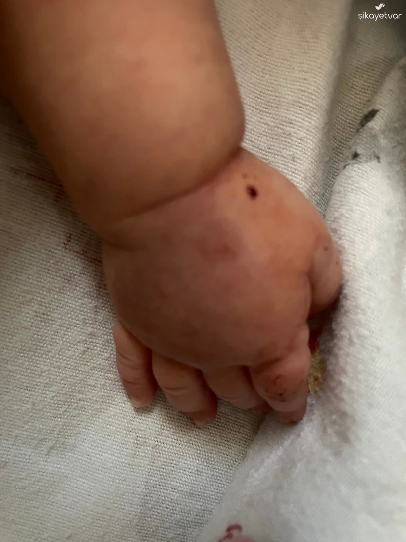 4 hemşire 2 aylık bebekten kan alamadı: Bebeğime adeta işkence çektirdiler - Resim : 1