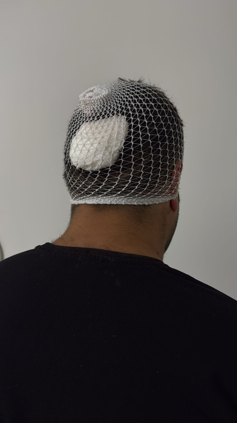 İYİ Partili yönetici gazeteciye saldırdı! - Resim : 2