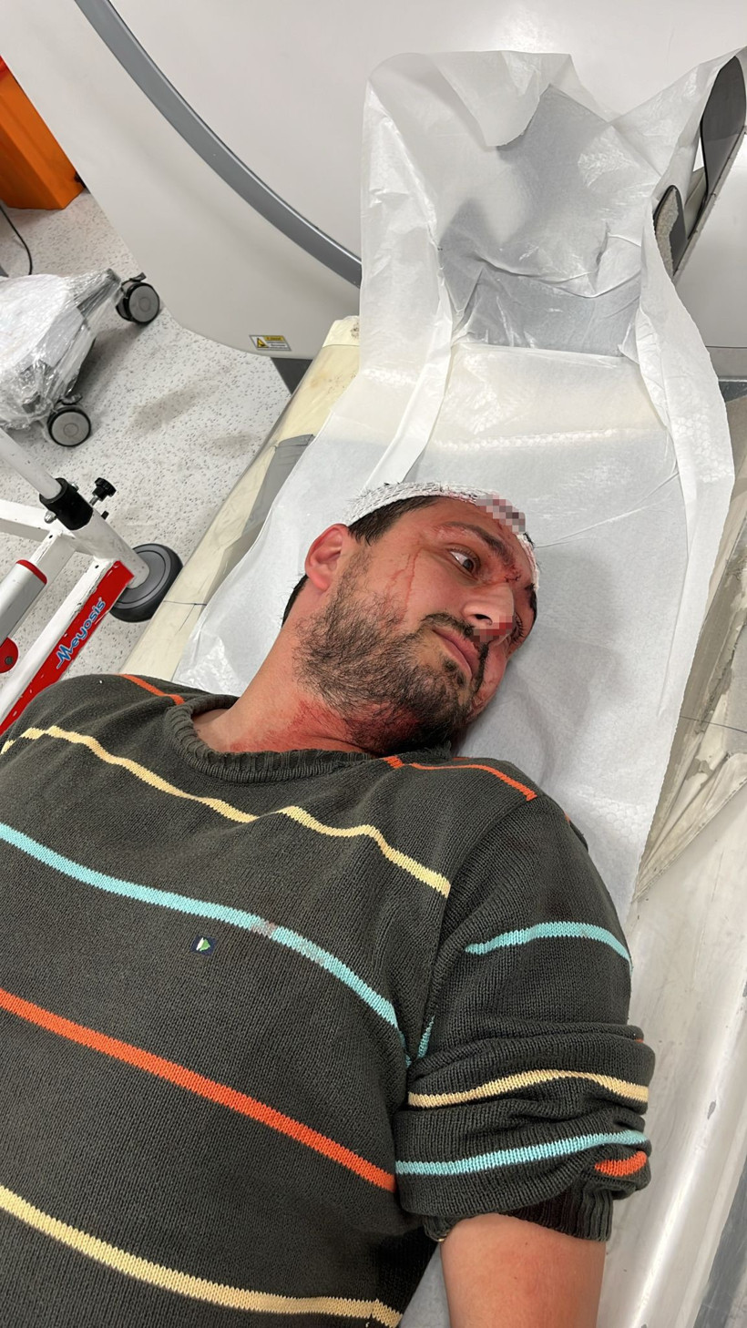 Vicdanları yaralayan olay: Savunmasız otizmli şahıs darbedildi! - Resim : 4