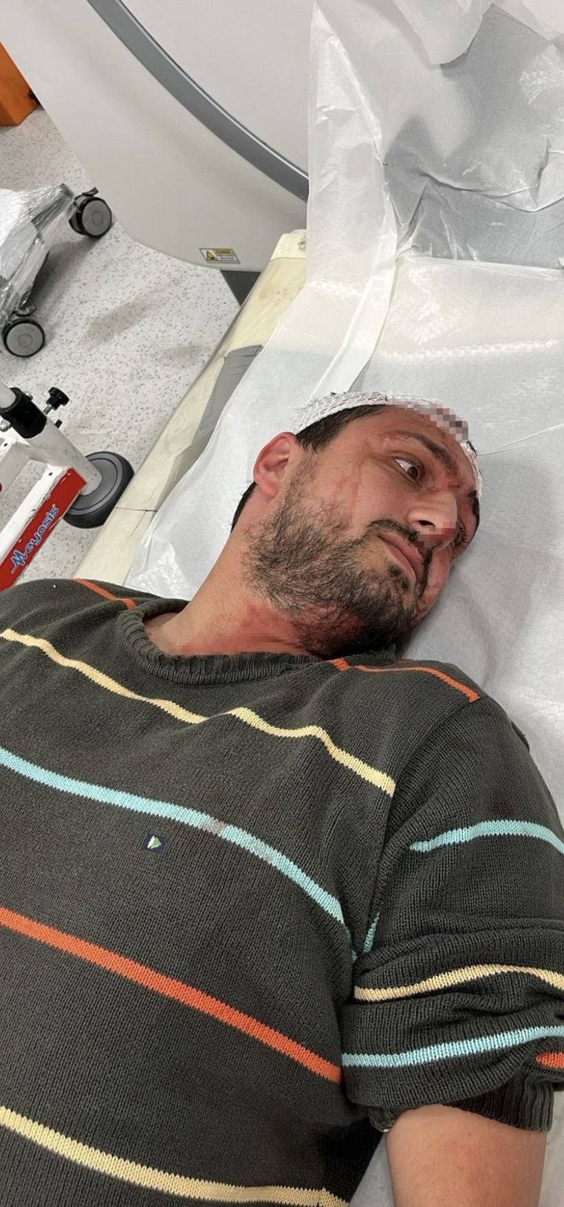 Engelli bireyi odunla darp etti, 3 yıl hapis cezası aldı! - Resim : 2