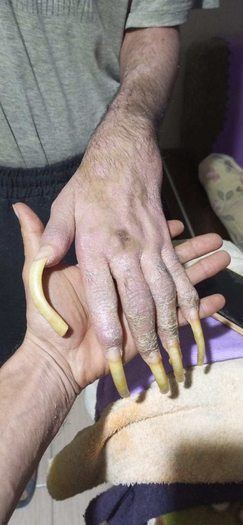 Yıllardır ne evden çıkıyor ne de duş alıyor! İşte sebebi... - Resim : 2