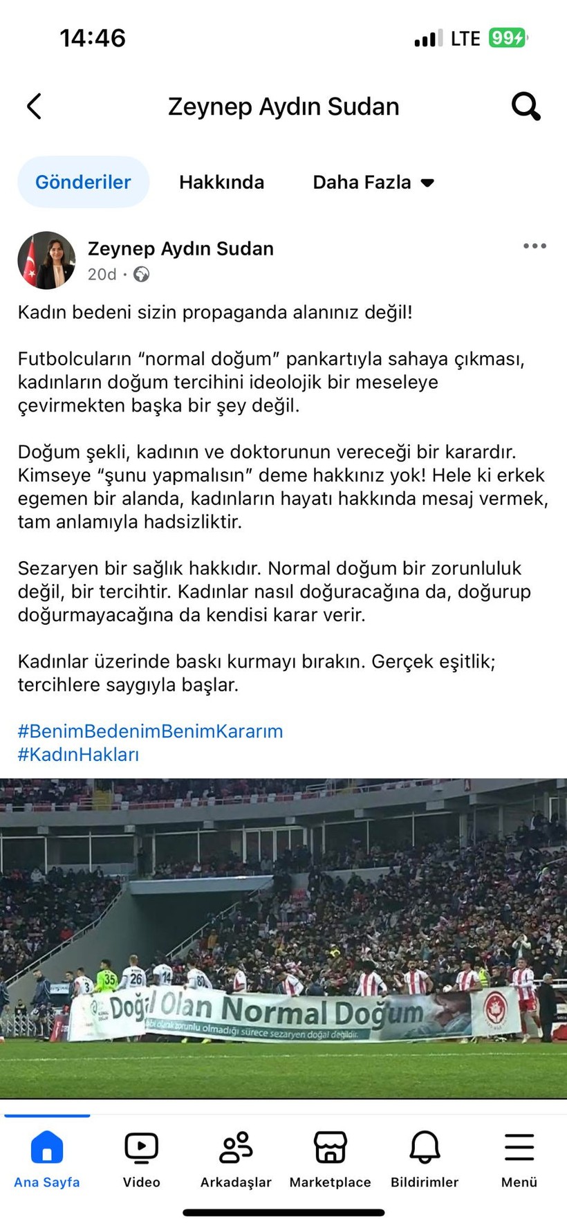 Zeynep Sudan’dan “normal doğum pankartına” tepki: “Kadınlar üzerinde baskı kurmayı bırakın!” - Resim : 1
