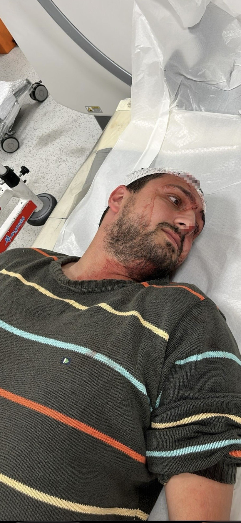 Otizmli genci darbeden şahıs hakkında mahkeme kararını verdi - Resim : 3