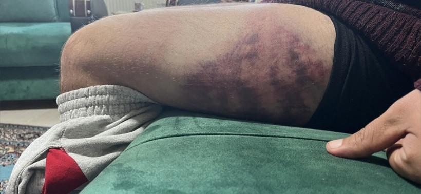 Engelli bireyi odunla darp etti, 3 yıl hapis cezası aldı! - Resim : 1