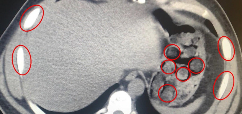 Midelerinden çıkan "Yok artık" dedirtti! - Resim : 1