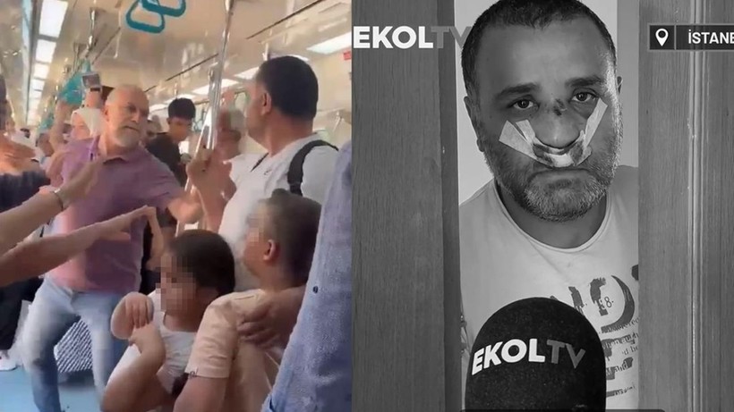 Çocuklarının gözü önünde yumruklandı - Resim: 3