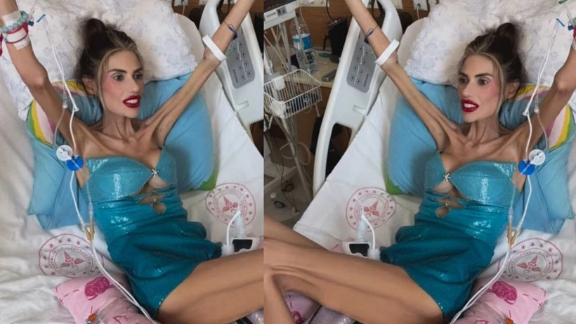 Anoreksiya Nervoza Hastalığına Yakalanan Nihal Candan 23 Kiloya Düştü! O Halini Görenler Şaştı Kaldı - Resim: 5