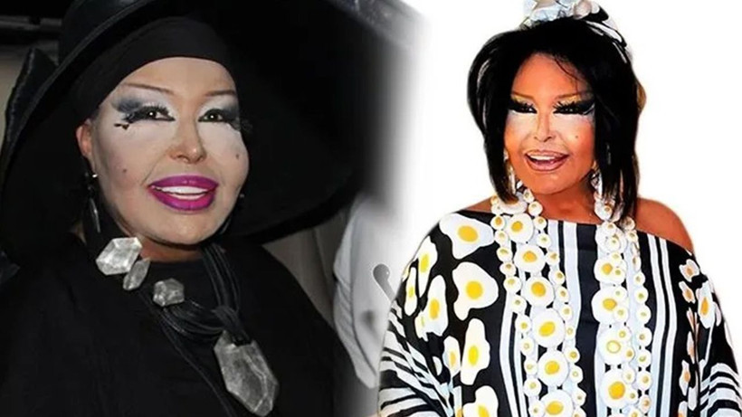 73 Yaşındaki Bülent Ersoy Açtı Ağzını Yumdu Gözünü! Tokatlayıp Yataktan Atarım.." - Resim: 7